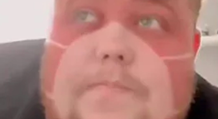 Un Hombre Se Quema La Cara Con El Sol Y Su Marca De La Mascarilla Se Hace Viral Es Real O Es Un Montaje Marca