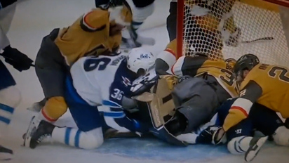 Winnipeg Jets player took skate to face, needed 75 stitches, and