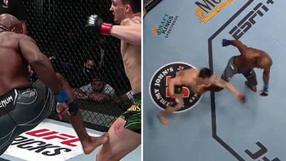 Ufc Broken Leg Gif